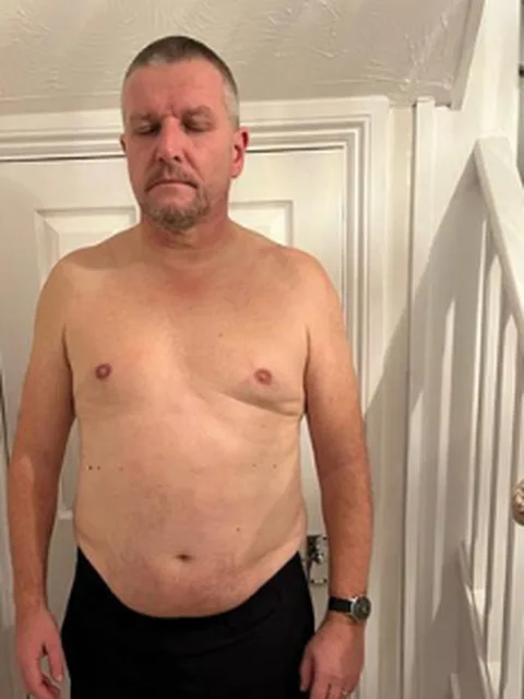 Andy before
